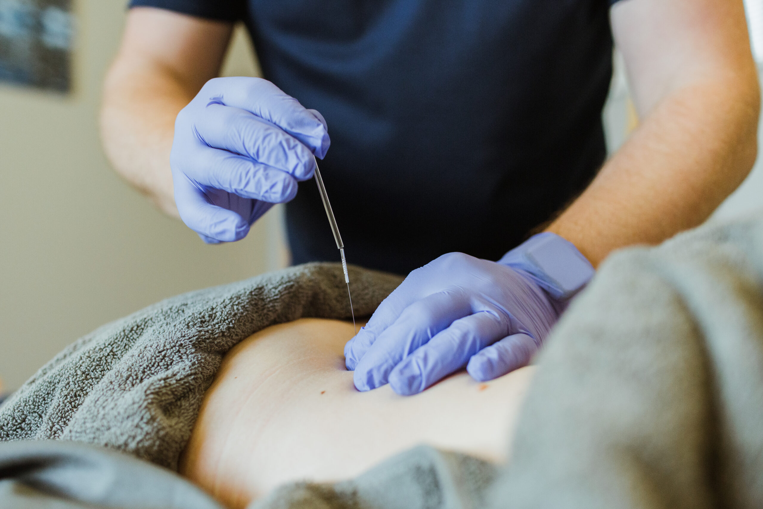 Integrative Dry Needling 